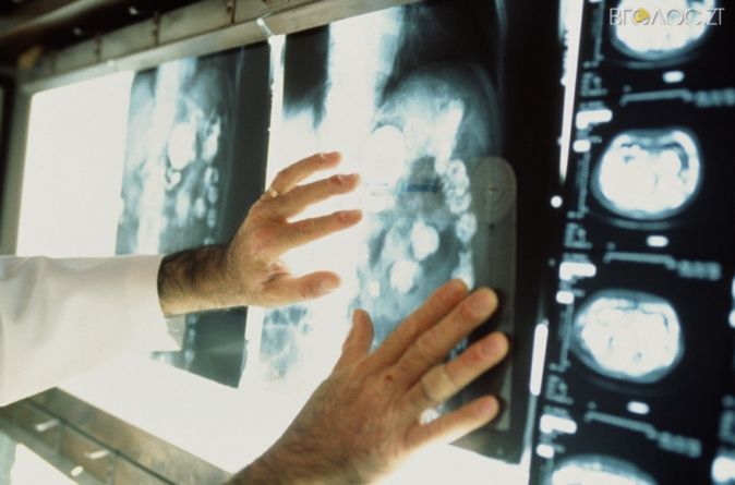 Для обласного онкодиспансера придбають мамограф майже за 12 мільйонів