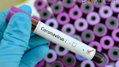 У немовляти з Коростишівського району лабораторно підтвердили коронавірус