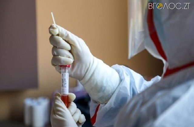 20 нових випадків захворювання на коронавірус виявили на Житомирщині за добу