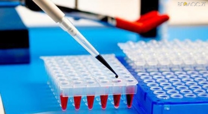 Стало відомо, хто може безкоштовно пройти тест ІФА на коронавірус у Житомирі