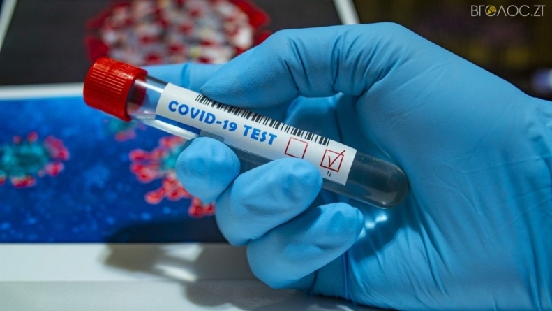 За добу 37 нових інфікованих COVID-19 виявили на Житомирщині