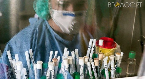 На Житомирщині вже виявили 5121 випадків інфікування COVID-19