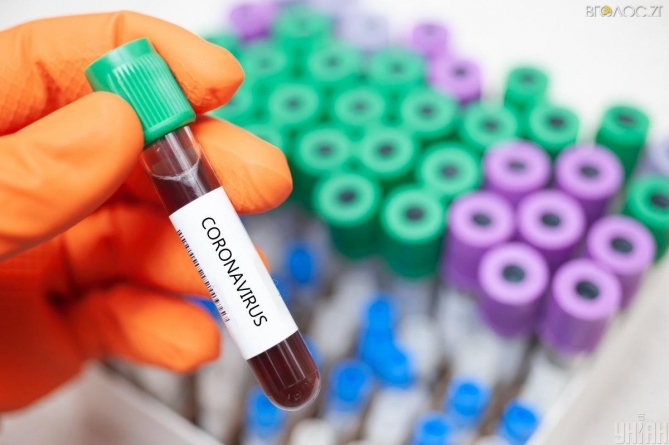 Протягом останньої доби на Житомирщині виявили 467 хворих на коронавірус