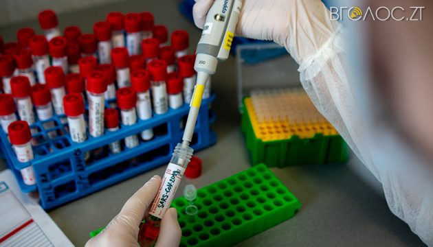 Антирекорд: лише за добу на Житомирщині виявили 537 інфікованих COVID-1