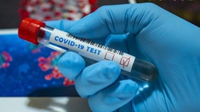 За минулу добу зареєстрували 13 нових лабораторно підтверджених випадків COVID-19