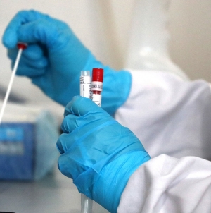 За добу на Житомирщині зафіксували 740 нових випадків коронавірусу
