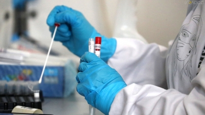 Протягом доби 20 лютого на Житомирщині зафіксували 480 нових випадків коронавірусу