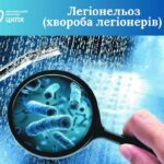 Легіонельоз (хвороба легіонерів): що потрібно знати